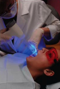 Velscope Oral Cancer Detection