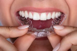 Invisalign in Medford NJ