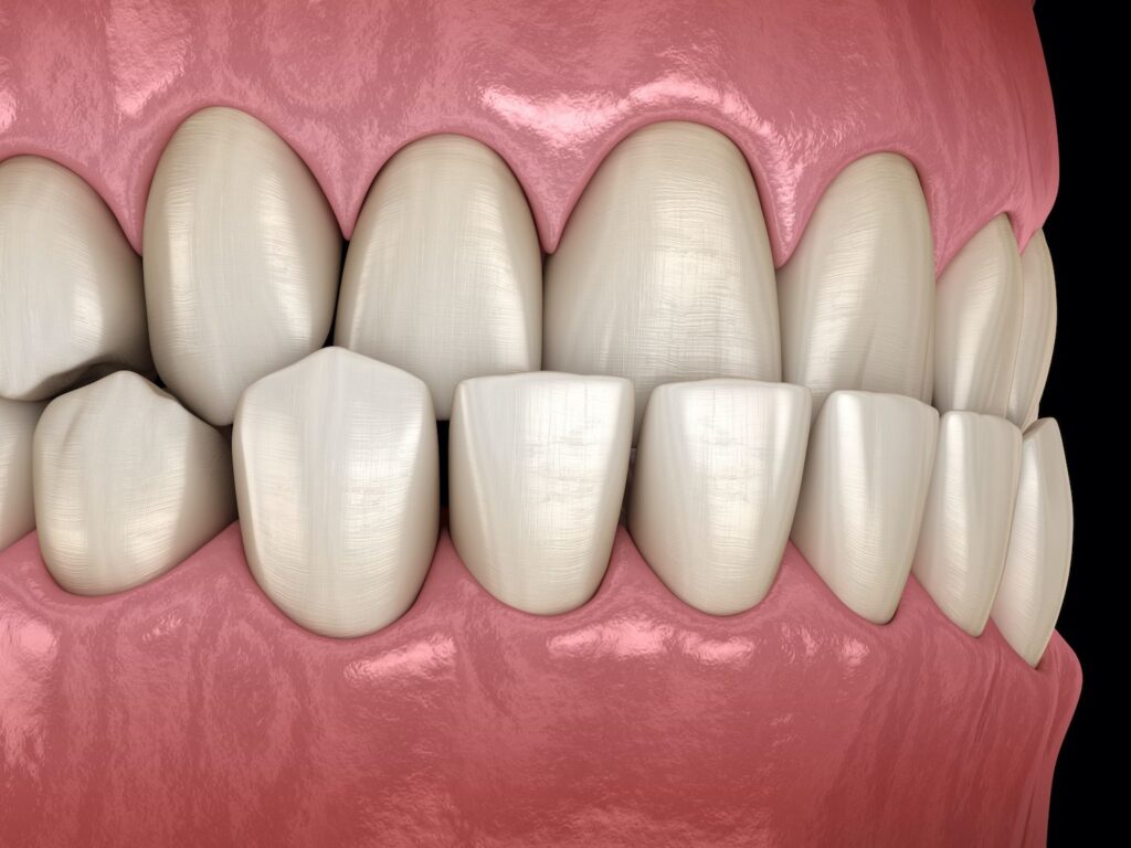All About Gums